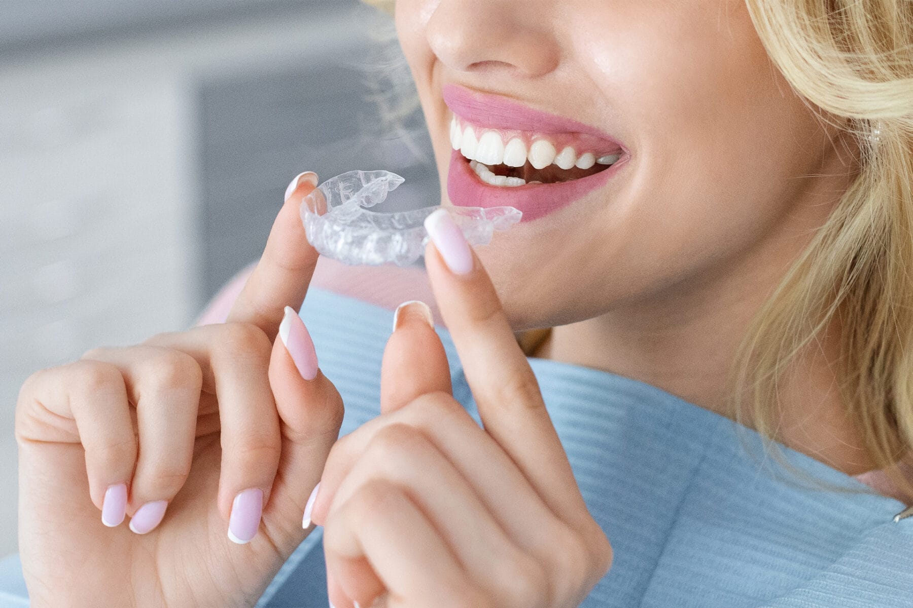 Ventajas de la ortodoncia invisible