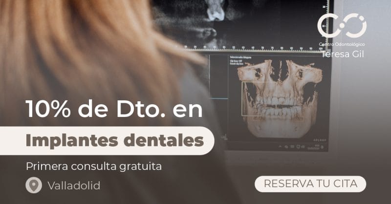 promoción implantes dentales valladolid