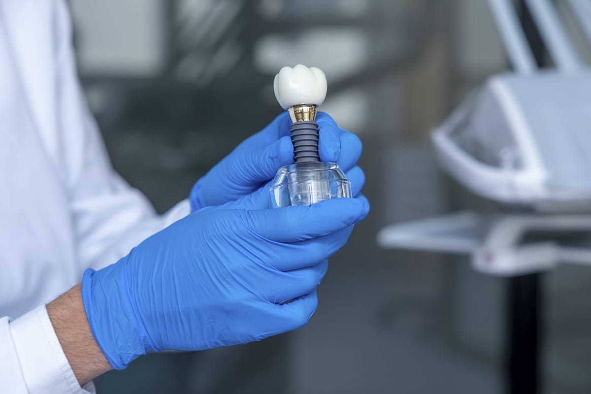 Cuidados despues de un implante dental